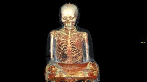 reve mummified monk ct scan 480 270